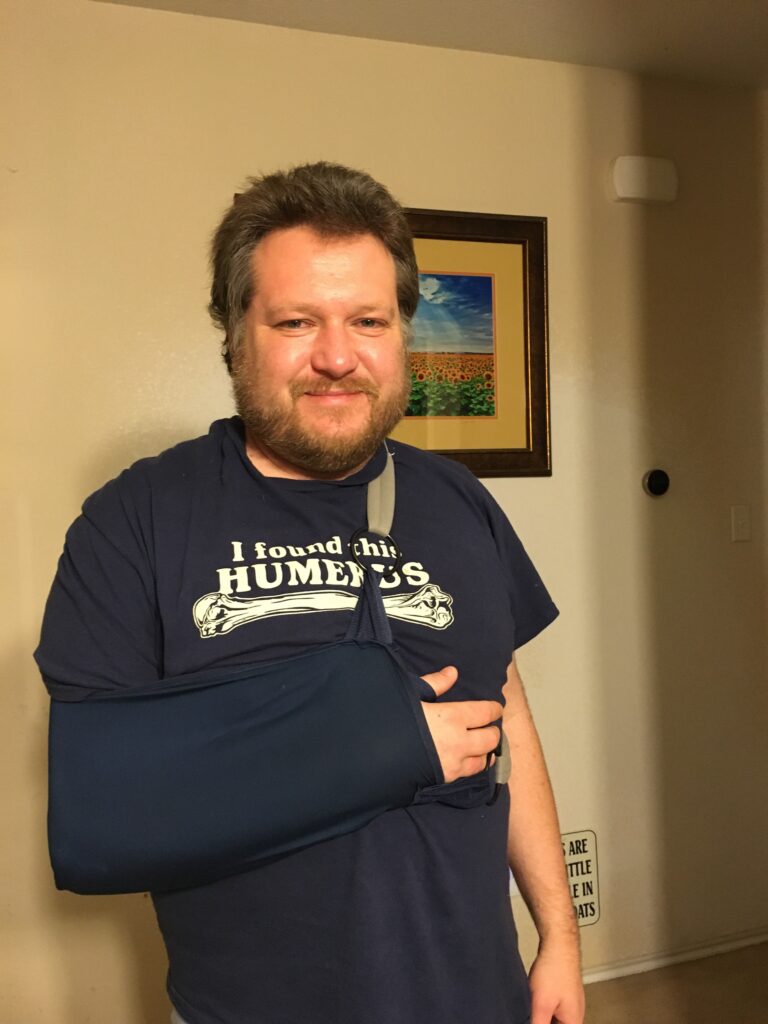 Broken Humerus